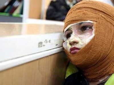 پیامدهای بی‌توجهی به ایمنی و هزینه‌های سنگین پانسمان سوختگی